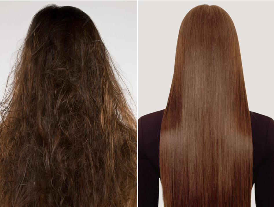 Nanoplastia Hair Treatment in India: Get Silky, Glass-Like Hair with Zero Damage